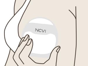 NCVI Milk Collector 8797 EASY TO USE STEP 1